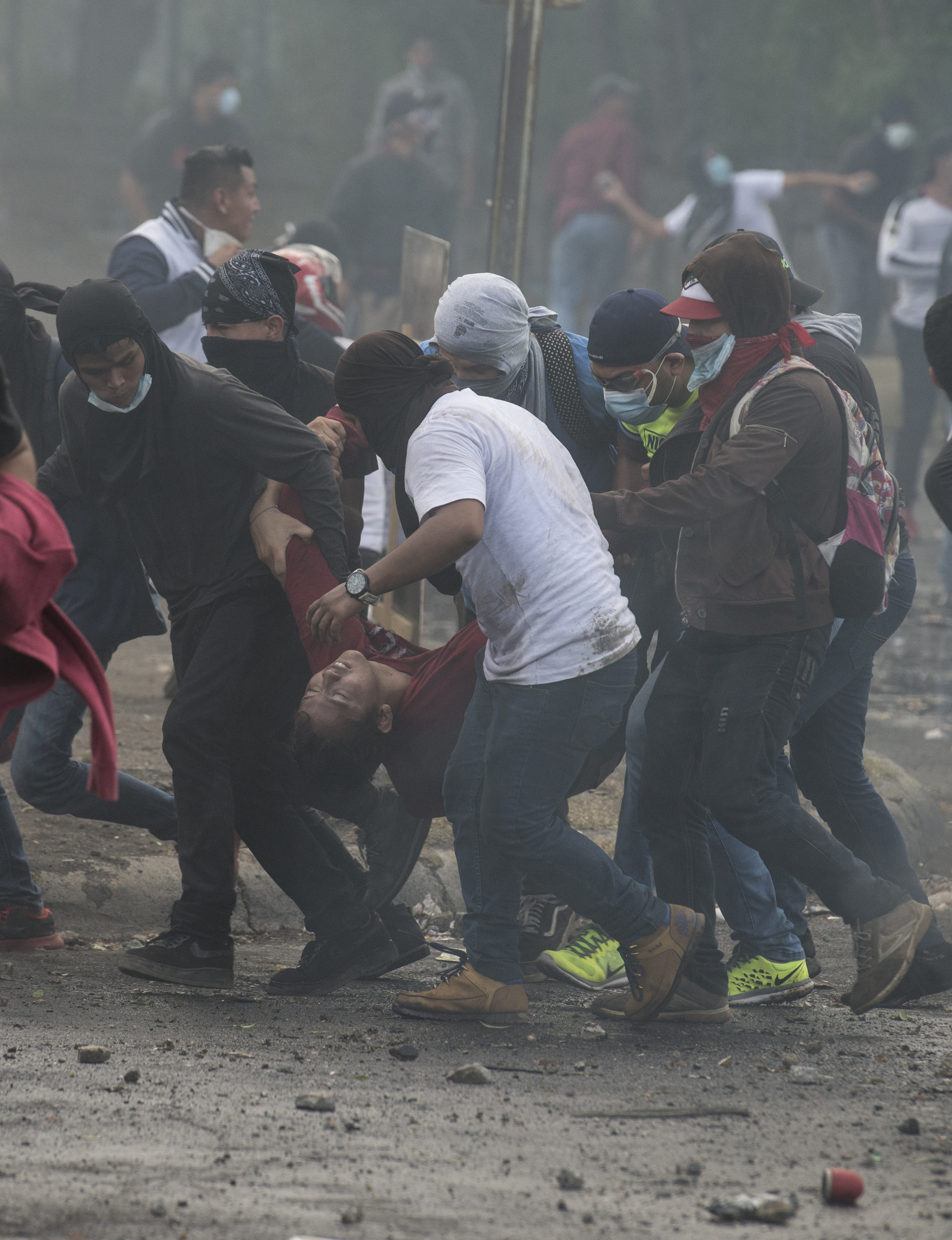 El 21 de abril este ciudadano que enfrentaba con piedras a la Policía fue alcanzado por una bala, que le impactó en la cabeza.